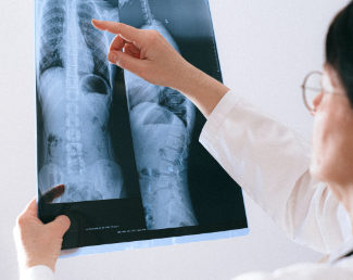Person reading an x-ray | Granville Health System