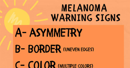 Melanoma warning signs infographic