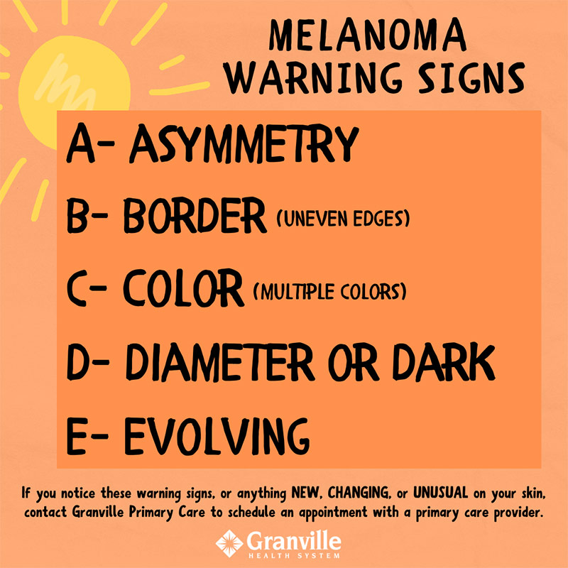 UV Safety Awareness Month- The ABCDEs of Melanoma