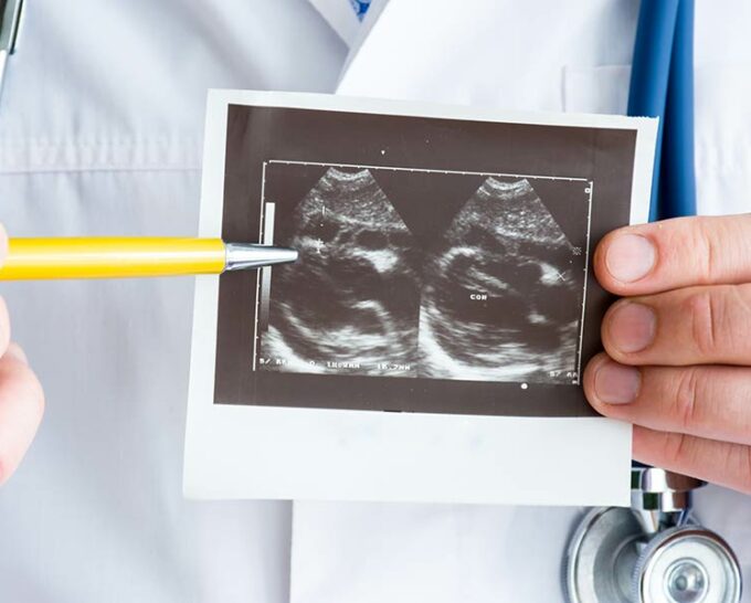 Photo of a doctor holding an Echocardiography print out